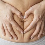 How To Get Rid Of Stretch Marks, Stretch Marks, Stretch Marks Cream, Remove stretch marks, Self Care, Body Care, Skin care, Stretch Marks removal cream, stretch marks treatment, skin care treatment, home remedy to remove stretch marks, in-office treatment to remove stretch marks, skin care products, What are the reasons for stretch marks?, What are the risk factors of stretch marks?, How to protect against stretch marks?, FAQS On Removing Stretch Marks, Can tanning remove stretch marks?, Can we get rid of stretch marks permanently?, How to avoid getting stretch marks?,