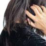 home remedies for dandruff