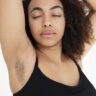 dark underarms - Learn about the causes, prevention, and treatments